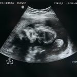 Pope Francis restores TLM as only Latin Rite; rad-trads switch to Novus Ordo